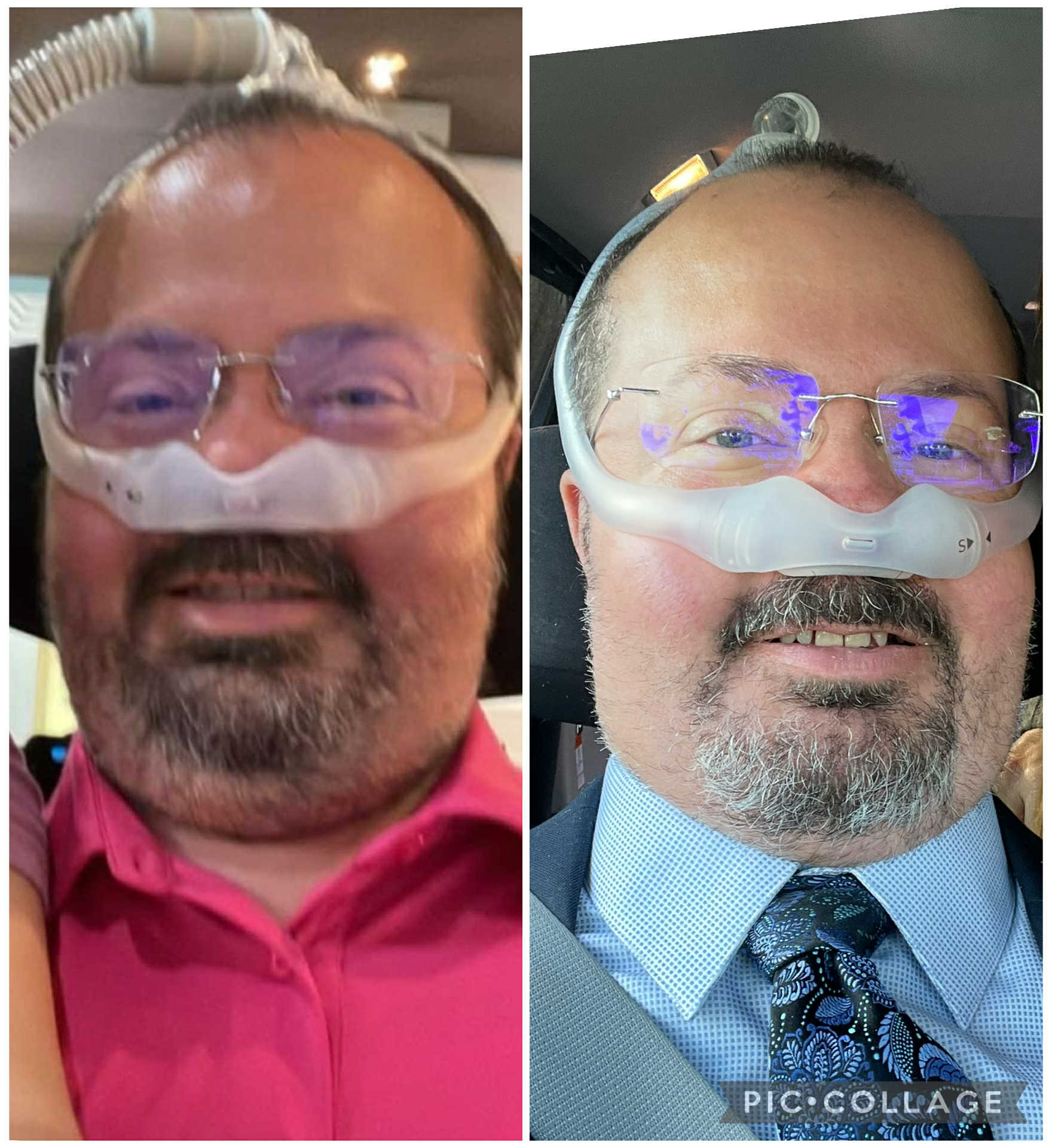 Earlier Ryan before-and-after comparison showing a pink shirt and later suit and tie