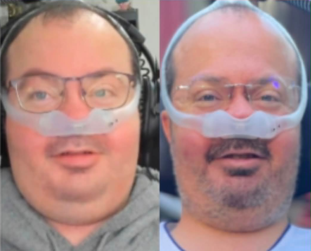 Ryan before-and-after face comparison